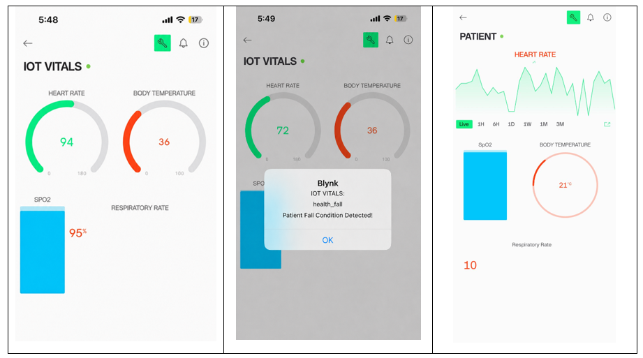 Blynk dashboard showing IoT Patient Monitoring System Kuwait with heart rate, SpO₂, body temperature, respiratory rate, and patient alert notifications