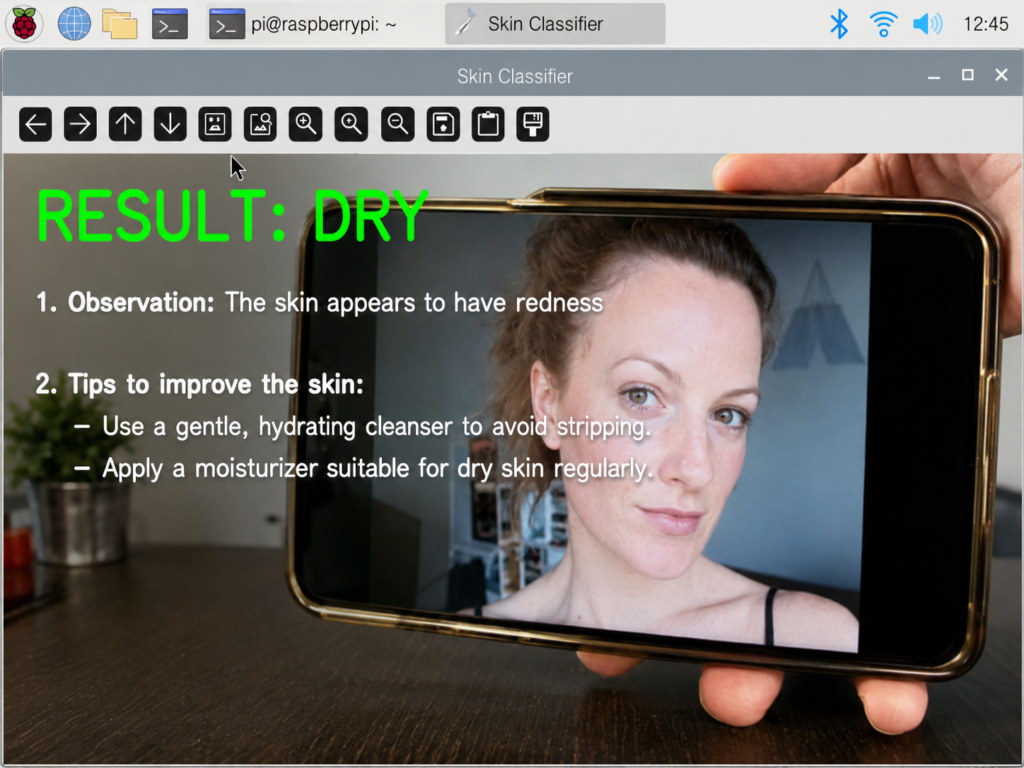Raspberry Pi skin classifier interface showing the result “Dry,” with a facial image and recommendations for gentle cleansing and regular moisturizing.